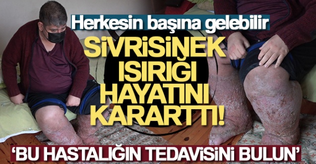 Sivrisinek, güvenlik görevlisinin hayatını kararttı