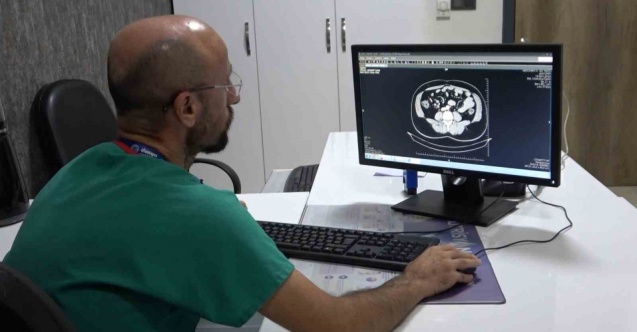 Uzmanlar vatandaşları kolon kanserine karşı uyardı