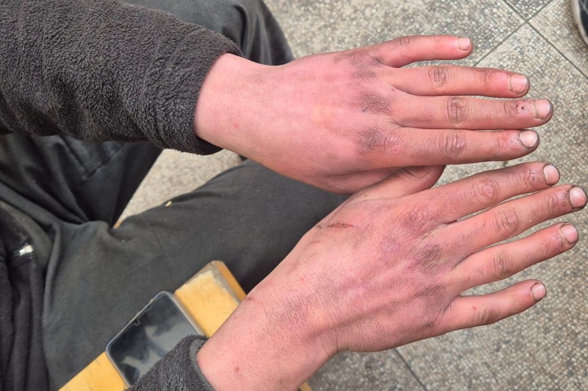 MESEM’li Emir, hayalini sanayiye gömdü