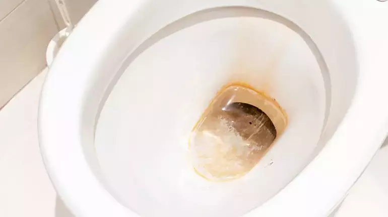 Mutfak Dolabınızın Derinliklerinden Gelen O Gizli Silah: Sararmış Tuvalet Taşlarını Bembeyaz Yapan Akıl Almaz Yöntem!